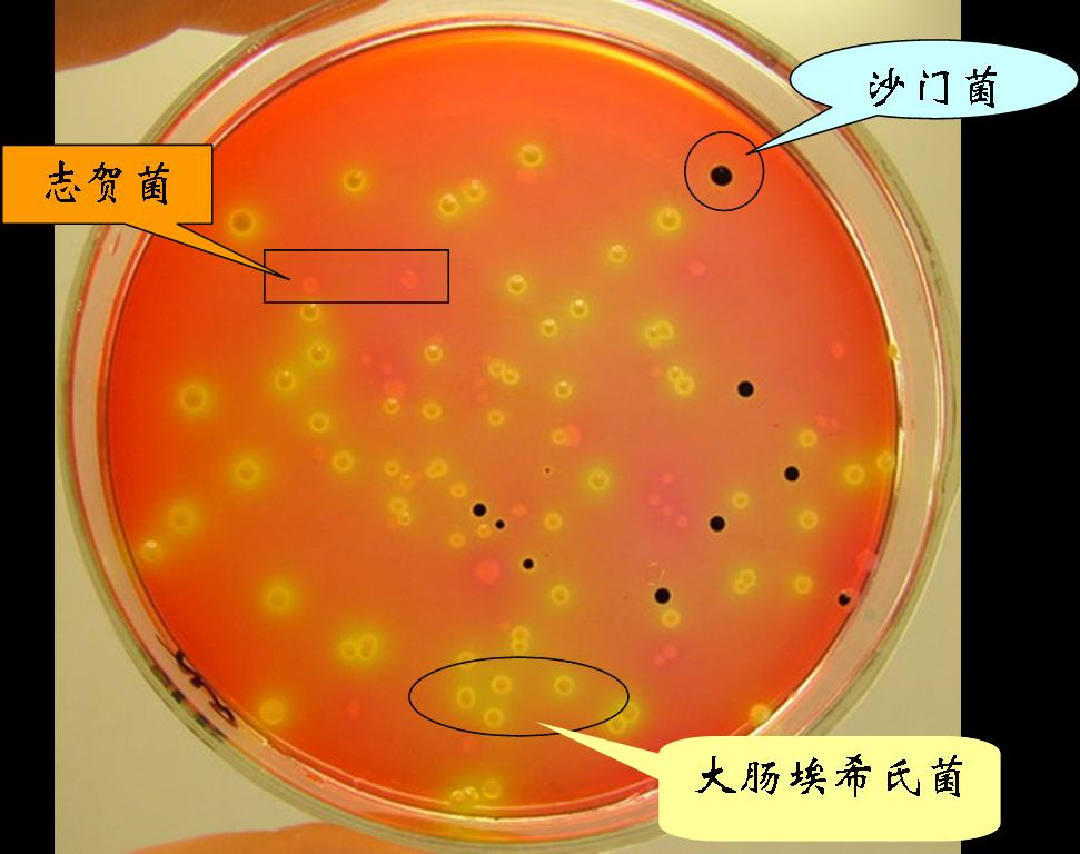 志贺氏菌的选择性培养基应用