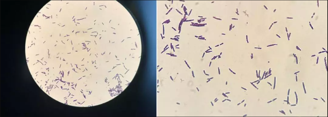 所以产气荚膜梭菌在分类学地位上面是"种(species,隶属于厚壁菌门梭