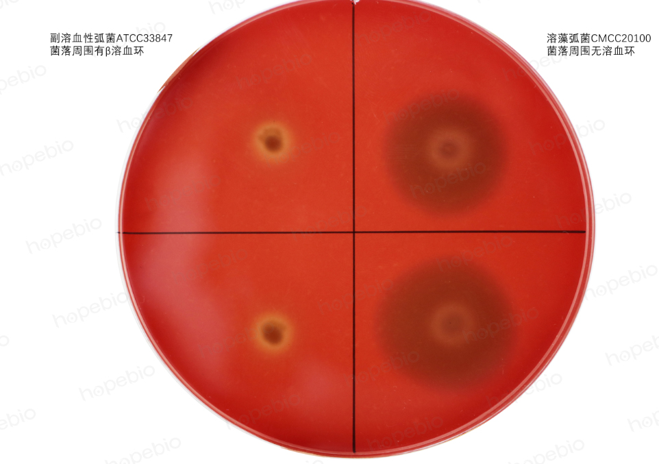 细菌溶血试验原理及现象青岛海博生物原创公司新闻丁香通 8998