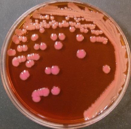 肺炎克雷伯菌在麦康凯培养基上培养48小时