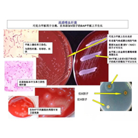 流感嗜血杆菌生化特征