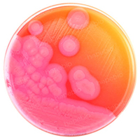 蜡样芽胞杆菌选择性培养基（盲样分离）