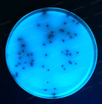 粪肠球菌――胆盐七叶苷琼脂