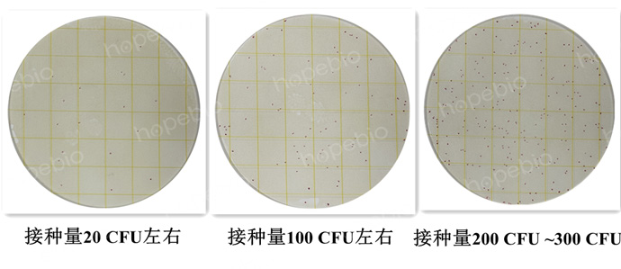 ��ͬ�������󳦰�ϣ�Ͼ�ATCC25922�ھ�����������Ƭ�ϵ�����չʾ