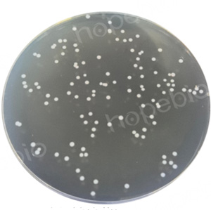 ��ͬ�ʿؾ�����MRS ��֬(����������)������״̬(2)