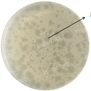 �󳦸˾��ɾ���MS2��˫��ƽ�����γɵ��ɾ���